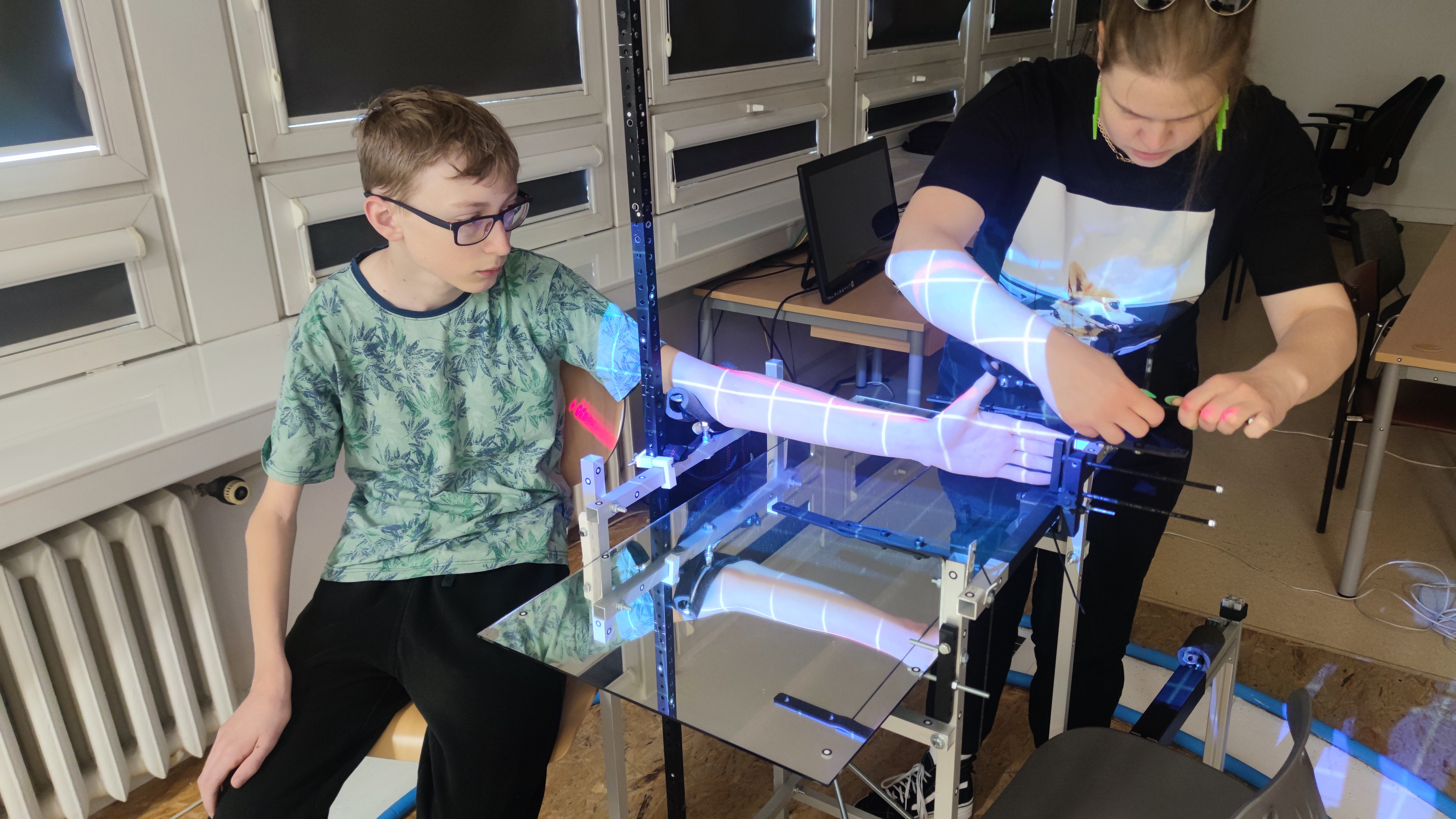 Optical 3D scanning of patient hand