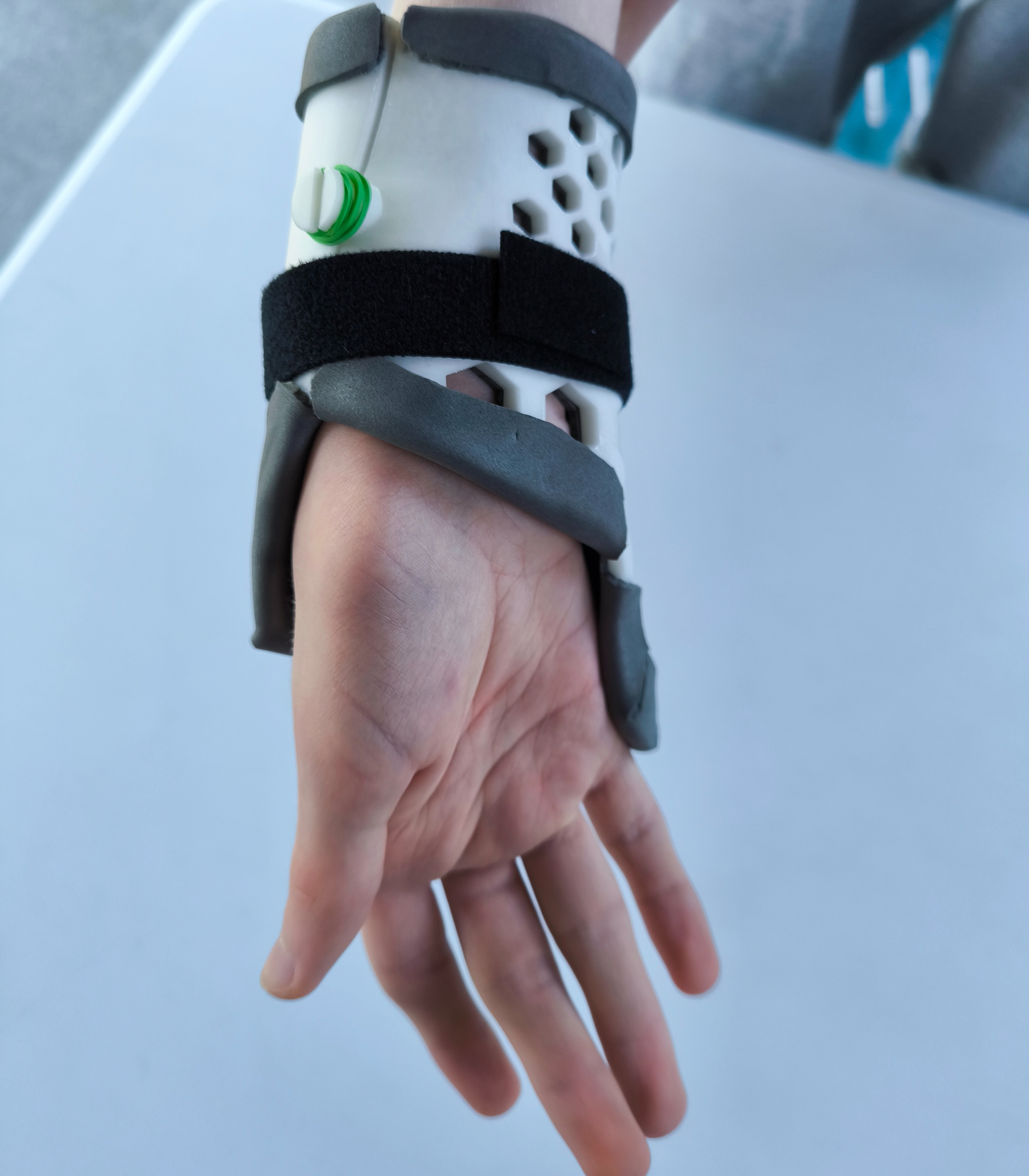 Orthosis on patient's hand